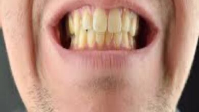 Photo of दांतों की पीलापन हटाने के लिए अपनाएं ये 5 घरेलू उपचार